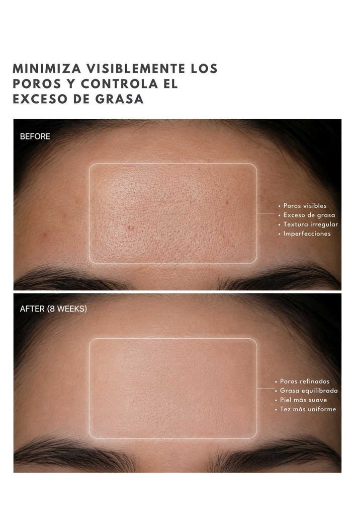 Suero Niacinamida 5% Ánimus Lab