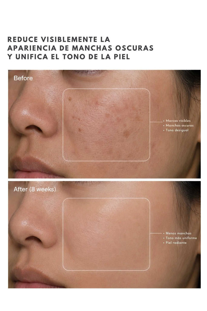 Suero Iluminador TRX Ánimus Lab