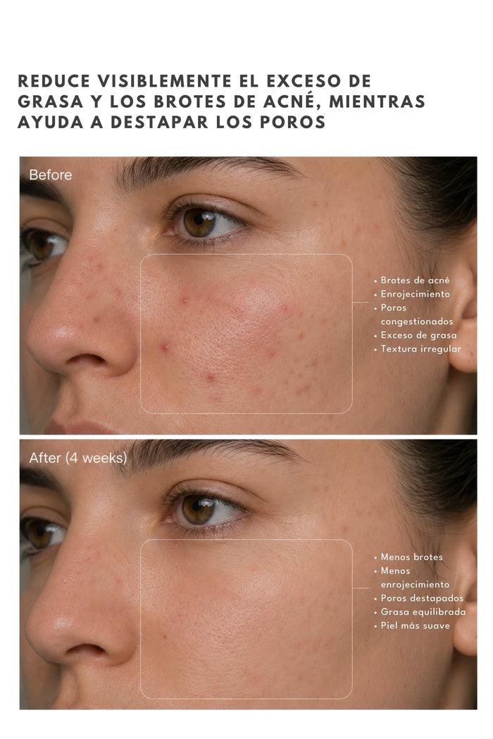 Limpiador Facial BHA 2% Ánimus Lab